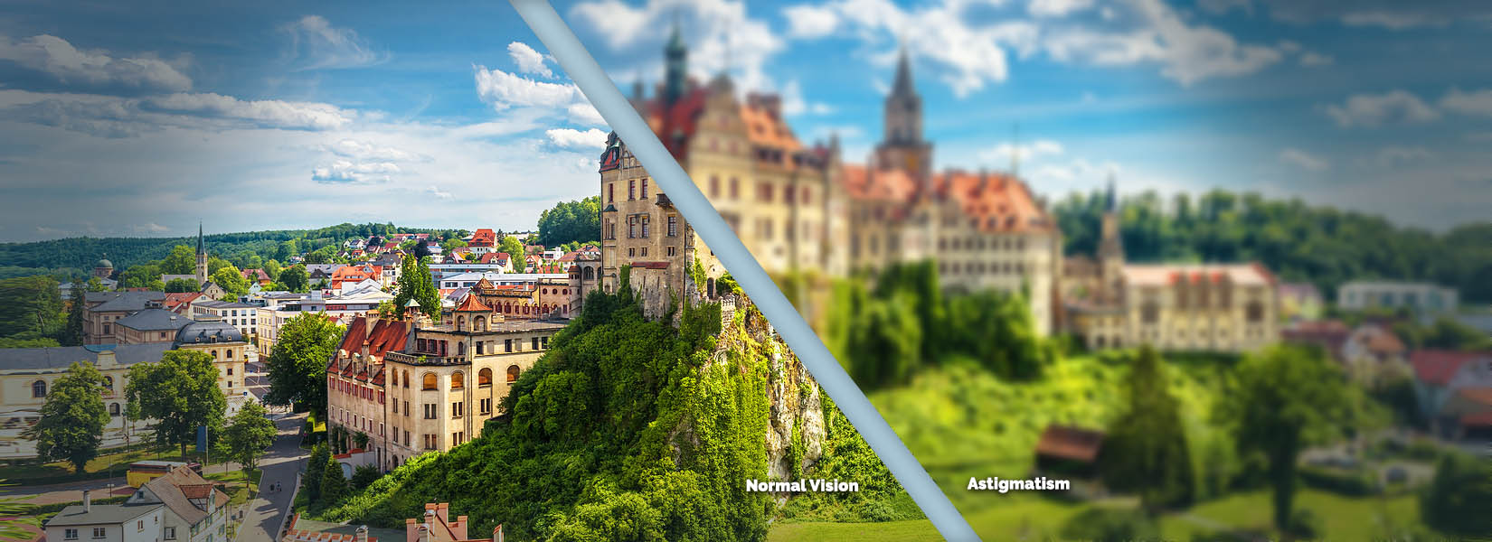 Astigmatism Treatment in Jacksonville