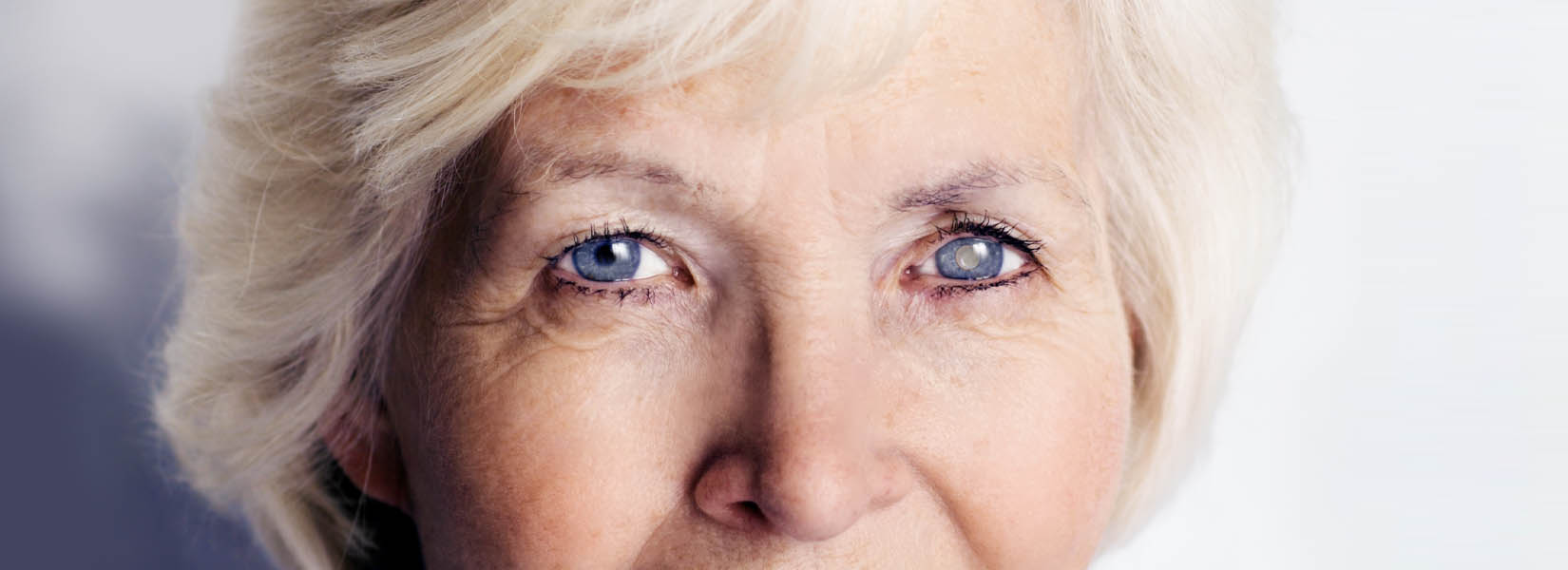 Cataract Surgery in Jacksonville